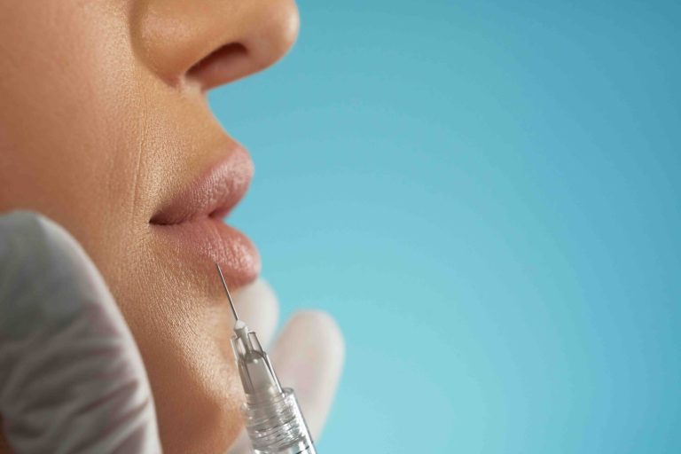 Blog 1 Filler labbra per correggere asimmetrie
